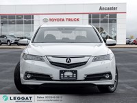 2016 Acura TLX 4dr Sdn SH-AWD V6 Elite